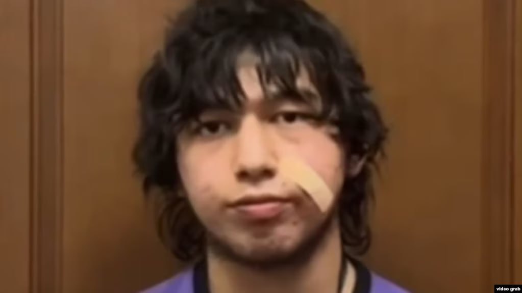 photo_5444924599322741517_y